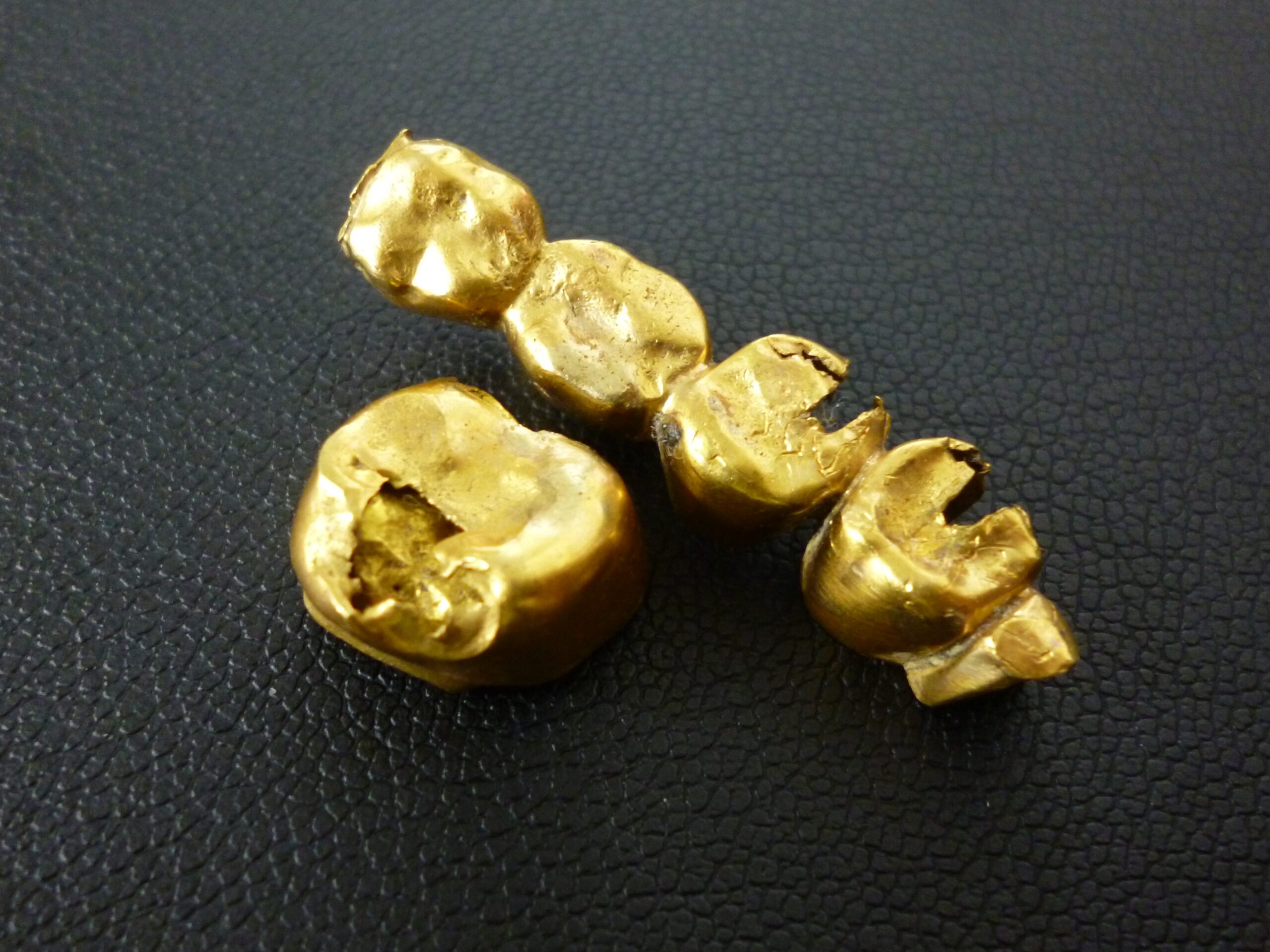 金歯・歯科用の金属