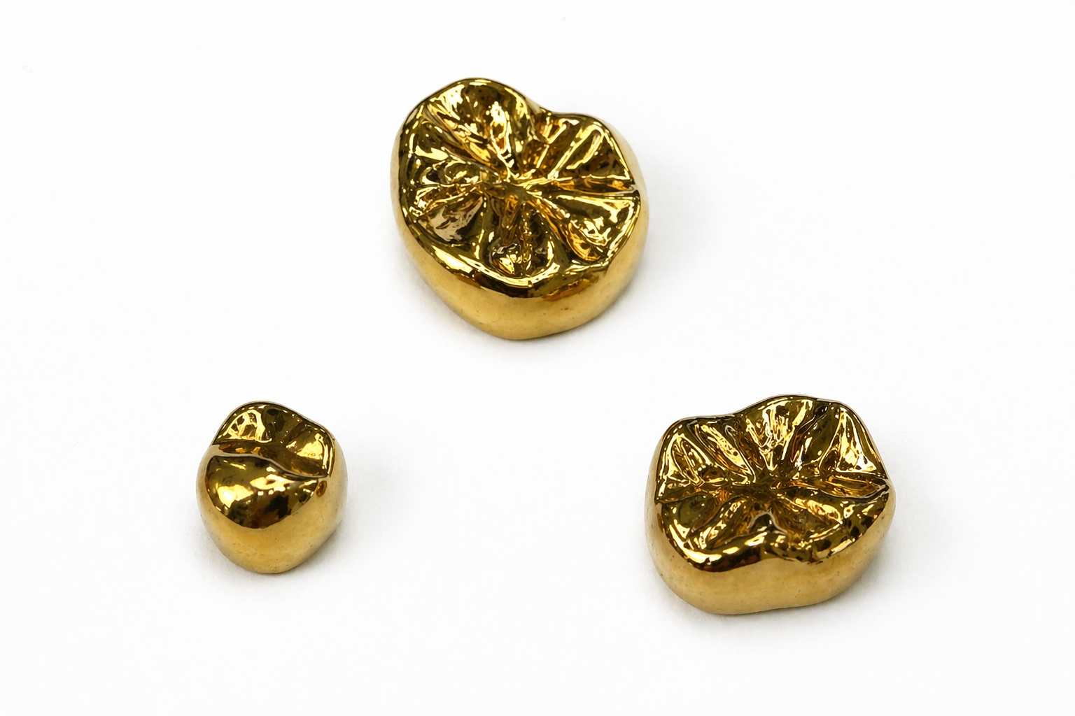 金歯の買取はできる？知っておきたい相場と安心して売るためのポイント